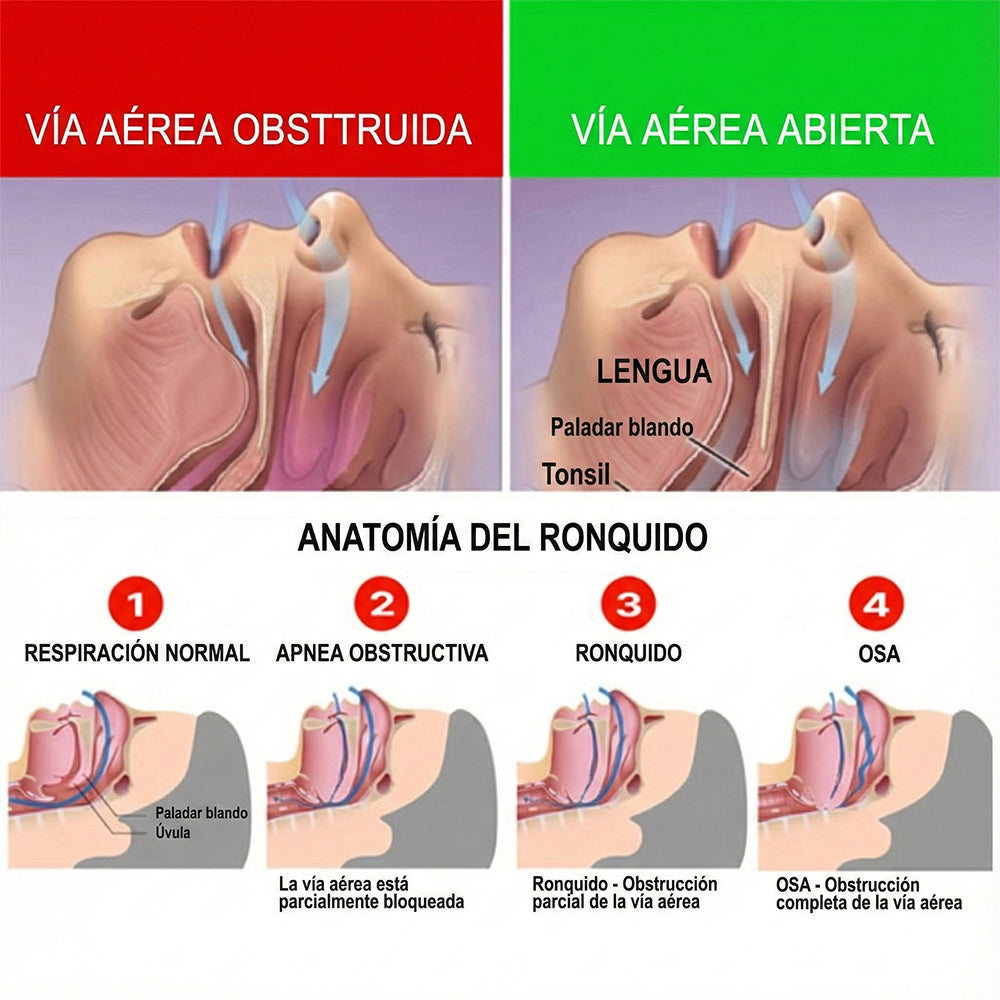 Quietmex Férula Antirronquidos