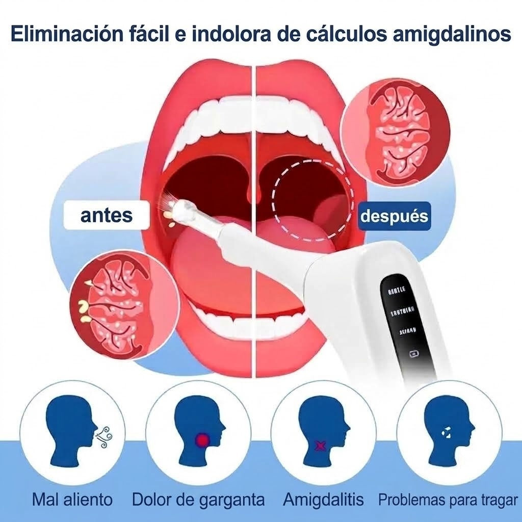 Tonsimox